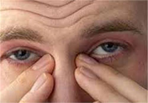 چشم‌رنگی‌ها اضطراب و افسردگی کمتری دارند